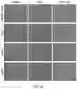 Fig. 19 - Methods of treating or preventing pyruvate kinase deficiency