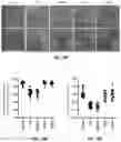 Fig. 32 - GENE THERAPY USING GENETICALLY MODIFIED VIRAL VECTORS