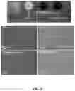Fig. 06 - A METHOD, AN ELECTROCHEMICAL SENSOR AND A SYSTEM FOR SELECTIVE DETECTION OF INFECTIONS