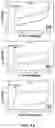 Fig. 15 - A METHOD, AN ELECTROCHEMICAL SENSOR AND A SYSTEM FOR SELECTIVE DETECTION OF INFECTIONS