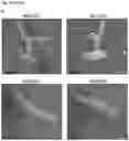 Fig. 17 - Recombinant type I CRISPR-Cas system and uses thereof for screening for variant cells