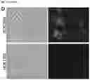 Fig. 22 - Recombinant type I CRISPR-Cas system and uses thereof for screening for variant cells