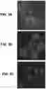 Fig. 04 - Method and System for Automated Image Analysis in Cancer Cells