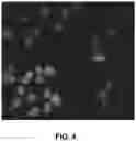 Fig. 05 - Method and System for Automated Image Analysis in Cancer Cells