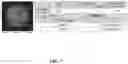 Fig. 08 - Method and System for Automated Image Analysis in Cancer Cells