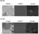 Fig. 10 - Method and System for Automated Image Analysis in Cancer Cells
