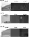 Fig. 11 - Method and System for Automated Image Analysis in Cancer Cells