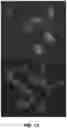 Fig. 13 - Method and System for Automated Image Analysis in Cancer Cells