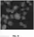 Fig. 14 - Method and System for Automated Image Analysis in Cancer Cells