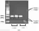Fig. 03 - Fluorescent PCR method for detecting HLA-B*15:02 allele and specific primer probe combination thereof