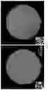 Fig. 03 - PAIRED MACROMOLECULE ABUNDANCE AND T-CELL RECEPTOR SEQUENCING WITH HIGH SPATIAL RESOLUTION