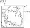Fig. 03 - ELECTRODE FOR ELECTROLYSIS, AND METHOD FOR PRODUCING ELECTRODE FOR ELECTROLYSIS