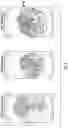 Fig. 06 - Image recognition processes for detecting tangling in a washing machine appliance