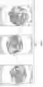 Fig. 08 - Image recognition processes for detecting tangling in a washing machine appliance