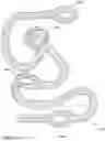 Fig. 04 - Safe metal free and hookless winch rope