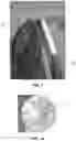 Fig. 02 - Protective Canopy Systems and Associated Methods of Installing and Taking Down