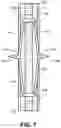 Fig. 09 - Wellbore notching assembly