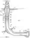 Fig. 02 - Cement placement in a wellbore with loss circulation zone