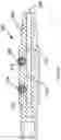 Fig. 07 - DOWNHOLE CLEANING APPARATUS
