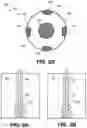Fig. 04 - Wellbore shaped perforation assembly