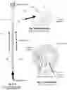 Fig. 06 - Electric submersible pump (ESP) rig less deployment method and system for oil wells and the like