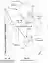 Fig. 07 - Electric submersible pump (ESP) rig less deployment method and system for oil wells and the like