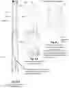 Fig. 09 - Electric submersible pump (ESP) rig less deployment method and system for oil wells and the like