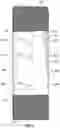 Fig. 04 - Downhole Pump Gas Eliminating Seating Nipple System
