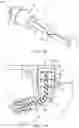 Fig. 09 - Extended orifice plug for a fluid system