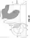 Fig. 26 - Exhaust valve assembly for a two-stroke internal combustion engine