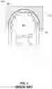 Fig. 02 - PERISTALTIC PUMP SYSTEMS