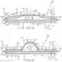 Fig. 11 - Braking systems comprising artificial muscles