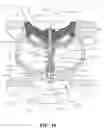Fig. 08 - Dual spring valve
