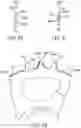 Fig. 11 - Alternating tooth chain ring