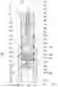 Fig. 05 - Valve