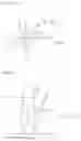 Fig. 11 - Ceiling-mounted type lighting device