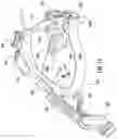Fig. 17 - Head wearable devices and methods