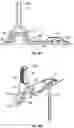 Fig. 14 - Bracket mount for securing solar panel rail guides on a roof