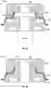 Fig. 18 - Bracket mount for securing solar panel rail guides on a roof