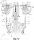 Fig. 14 - Crossover crossbow