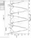 Fig. 13 - Robust step detection using low cost MEMS accelerometer in mobile applications, and processing methods, apparatus and systems