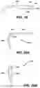 Fig. 37 - Eyewear with detection system
