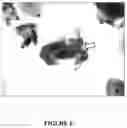 Fig. 07 - CYTOLOGICAL STAINING COMPOSITIONS AND USES THEREOF