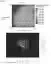Fig. 18 - Microscopic object collection system and microscopic object collection method