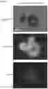 Fig. 29 - Microscopic object collection system and microscopic object collection method