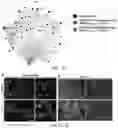Fig. 09 - Fibrosis model and methods of use thereof