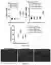 Fig. 13 - Fibrosis model and methods of use thereof