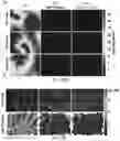 Fig. 20 - Fibrosis model and methods of use thereof