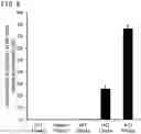 Fig. 10 - QUANTITATIVE DETERMINATION METHOD FOR Hex4, LYSO-GM1, Fuc-GlcNAc-Asn, AND LYSO-SULFATIDE INCLUDED IN CEREBROSPINAL FLUID