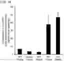 Fig. 15 - QUANTITATIVE DETERMINATION METHOD FOR Hex4, LYSO-GM1, Fuc-GlcNAc-Asn, AND LYSO-SULFATIDE INCLUDED IN CEREBROSPINAL FLUID
